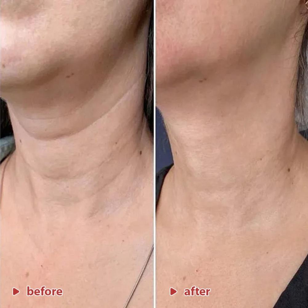 50ml Korean Koriderm Time Reve - Peptide Neck Cream recension och pris