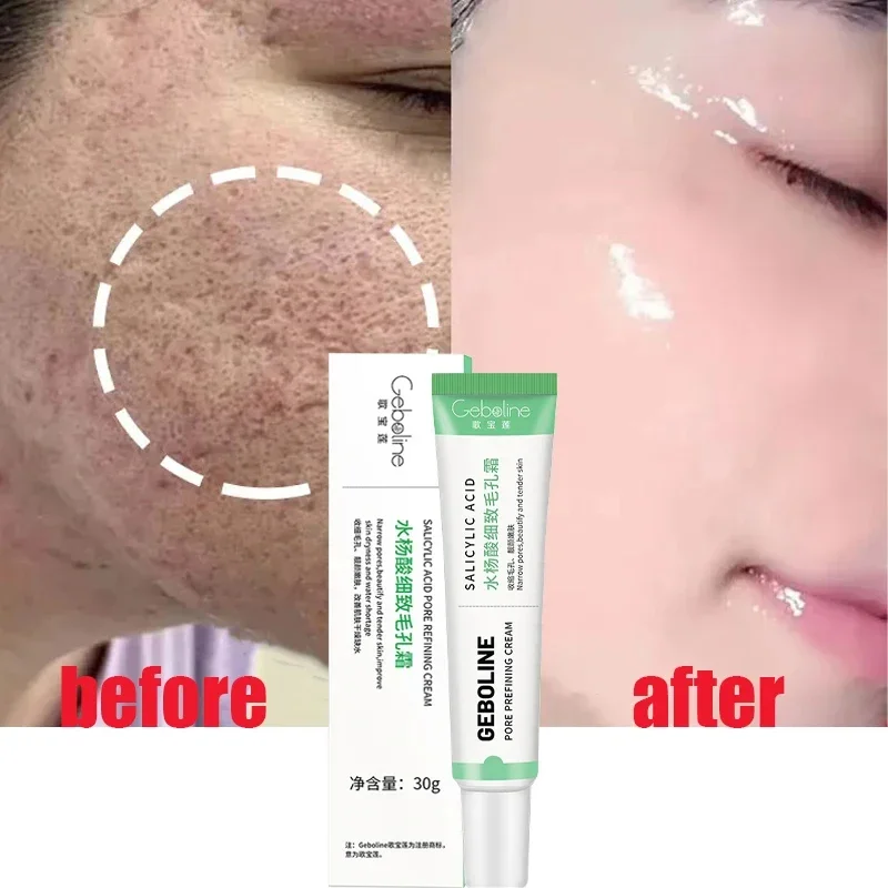 Salicylic Acid Pore Shrinking  - Skincare Salicylic Acid recension och pris