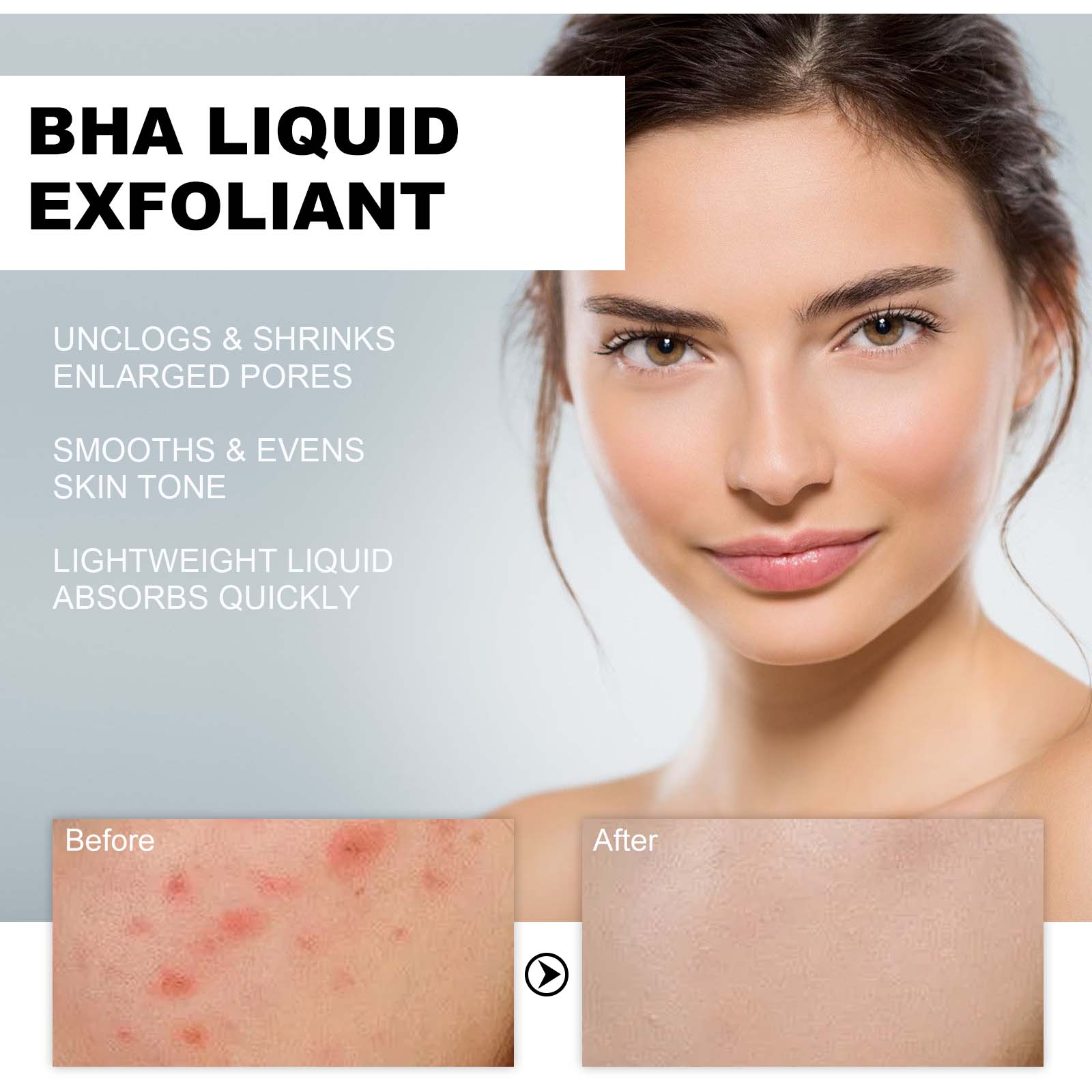 2% Salicylic Acid Liquid Exfol - Skincare Salicylic Acid recension och pris