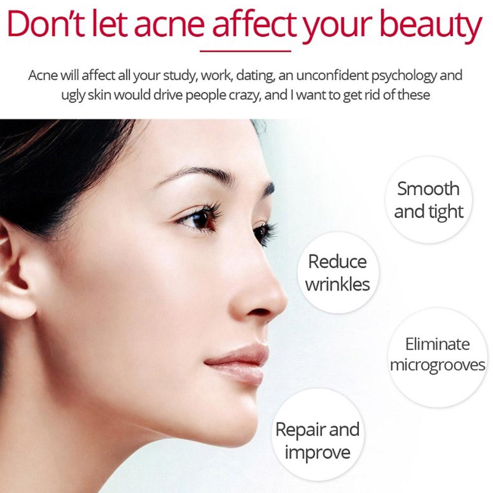 Retinol Lifting Firming Cream  - Skincare Retinol recension och pris