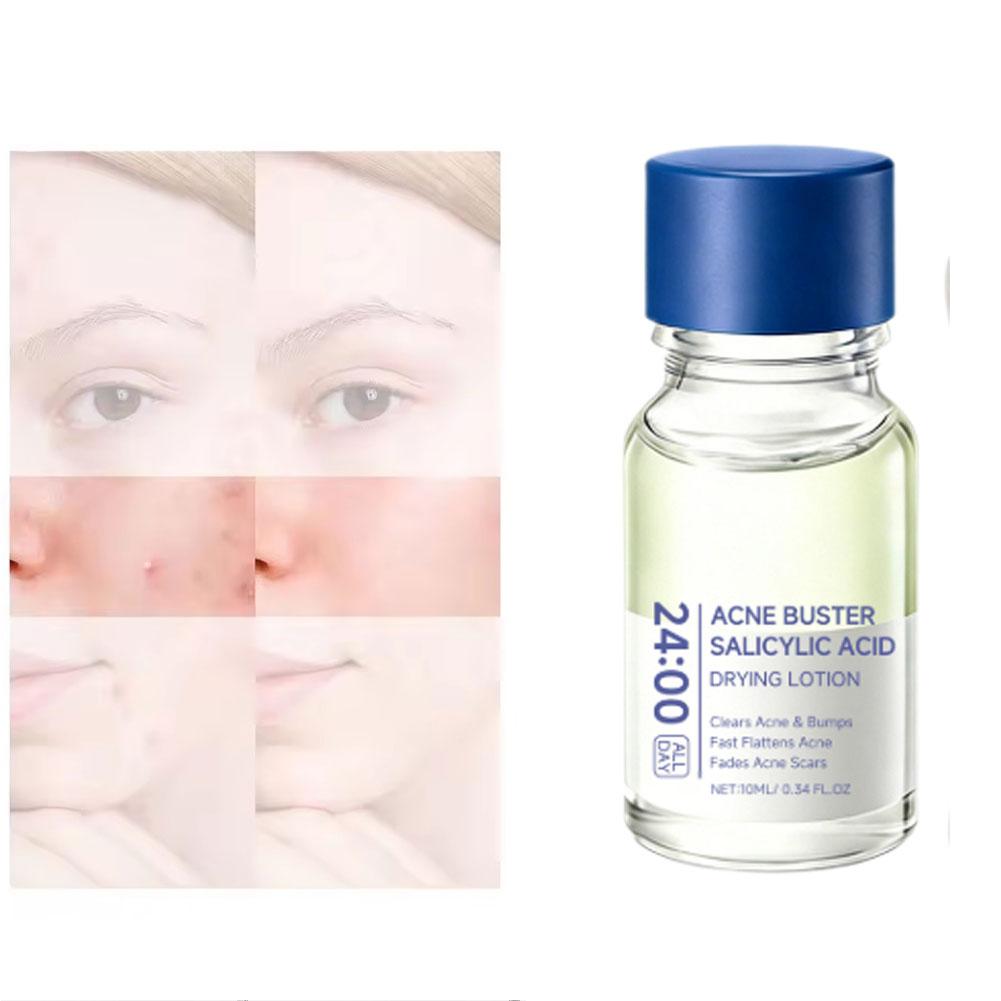Salicylic Acid Essence Treatme - Skincare Salicylic Acid recension och pris