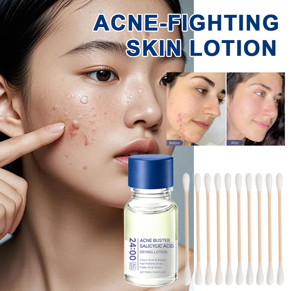 Salicylic Acid Essence Treatme - Skincare Salicylic Acid recension och pris